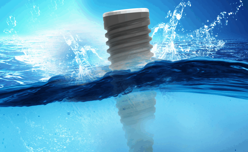 mesa_sistema_implantare