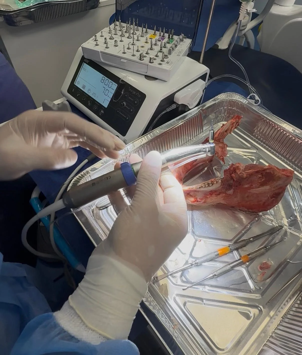 Physiodispenser e preparazione sito implantare